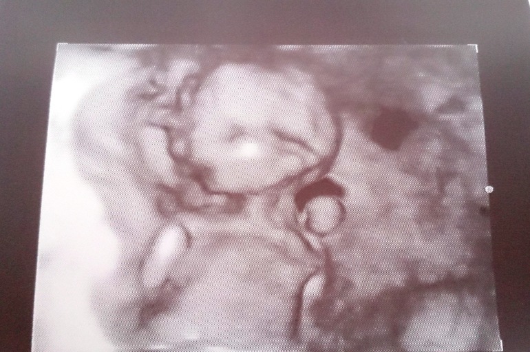 Отчёт о моей беременности с самого начала до 24-й недели