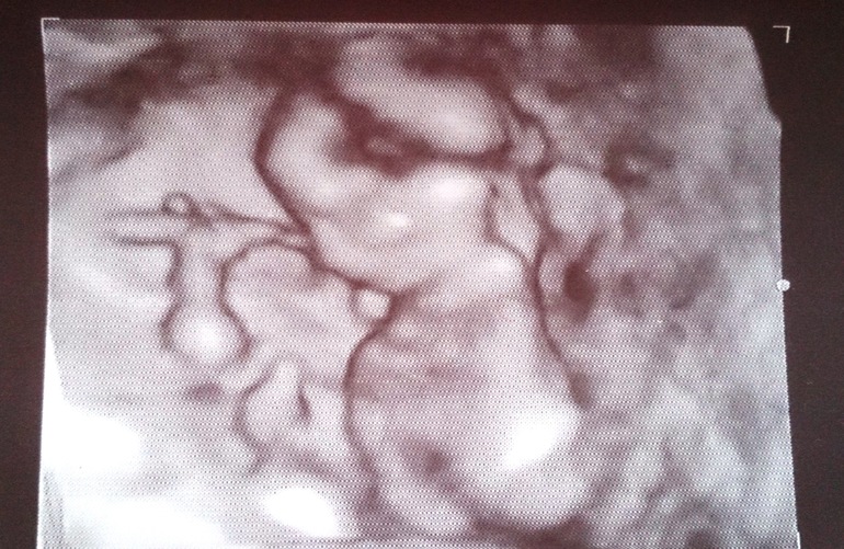 Отчёт о моей беременности с самого начала до 24-й недели