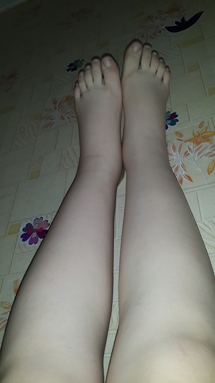 отёки:(ничего не помогает...:(