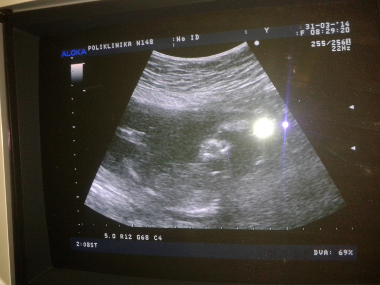 16недель5дней