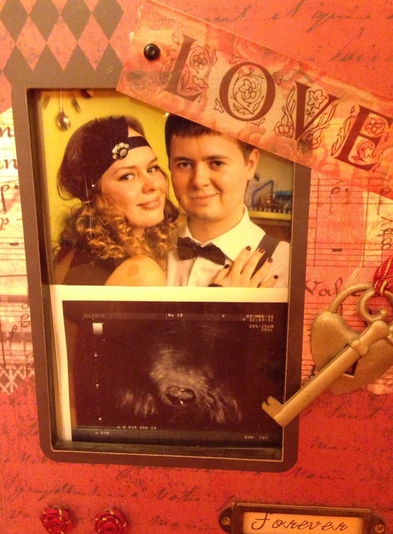 10-ая неделька ( 01.03.2014)