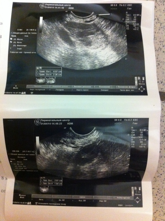 Фоликулометрия