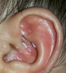 покраснели ушки